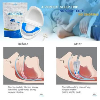Anti Snore Mouth-Piece